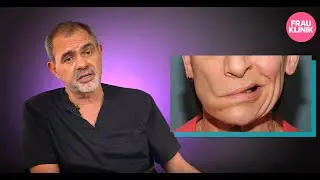 Ошибки хирургов при фейслифтинге и последствия. - СЕРГЕЙ НИКОЛАЕВИЧ БЛОХИН