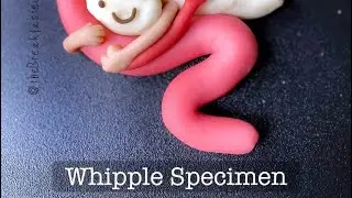 Playdough Surgery 🔪🍐 - Whipple Procedure - Gross Exam - Part II