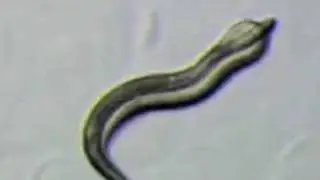 'Worm porn' video shows details of nematode sex