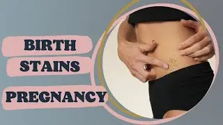 PREGNANCY | BIRTH STAINS | POST-NATAL