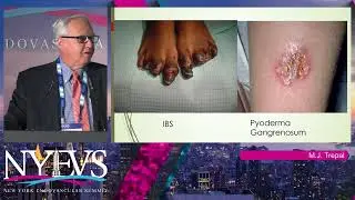 When to Biopsy an Ulcer   Michael J  Trepal
