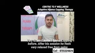 No side-effects of Hijama Cupping Therapy #hijama #cupping #Bangalore