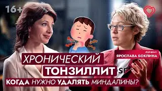 Хронический тонзиллит: когда нужно УДАЛЯТЬ МИНДАЛИНЫ?