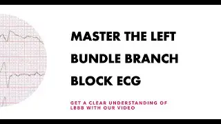 Master the Left Bundle Branch Block ECG: Get a clear understanding of LBBB with our video.