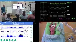 «Неонатальная респираторная поддержка с применением новейшего симулятора лёгких Lusi». Часть 3