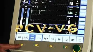 Pressure-Controlled Ventilation with Volume Guarantee (PCV-VG)