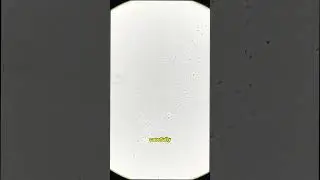 This bacteria DIDNT STAND a CHANCE!