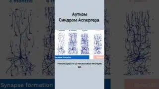 аутизм синдром Аспергера #мозг #наука #shorts