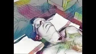 JFK Assassination ~ Altered Throat Wound