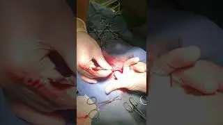 Male rabbit with a bladder herniation into the Left scrotal sac - surgical repair and neuter