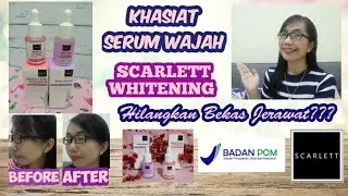 KUPAS TUNTAS SERUM WAJAH SCARLETT WHITENING + FULL REVIEW | Widya Pradani