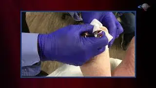 WCW: Trimming Toenails to Prevent Trauma