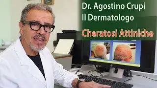 Agostino Crupi - Le Cheratosi Attiniche: come curarle