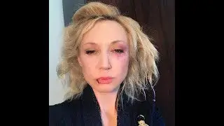 Что случилось с Кристиной Орбакайте этого следовало ождать