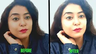 INSTANTLY REMOVE SUN TAN सालों की जमीं काली परत 10 मिनट में उतरेगी Get Fair Skin in summers COST-0/-