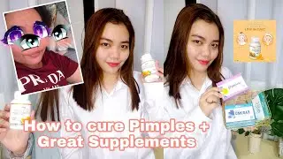 How to cure pimples + Great supplements