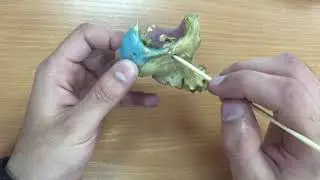 Верхняя челюсть.Анатомия