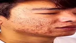 Green tea clean face oil control solid mask