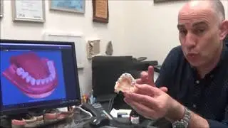 השתלת שיניים ממוחשבת