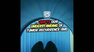 Revolutionary Findings on Glioblastoma Recurrence