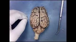Dissection of Sheep Brain