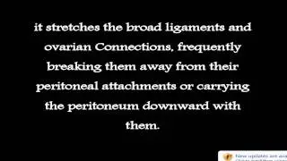 Looking for UTERINE DISPLACEMENT? Yes, UTERINE DISPLACEMENT. It's all here!