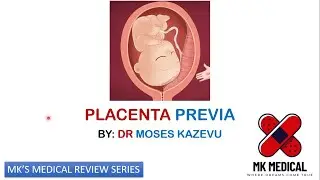 Placenta previa