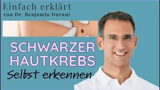 Wie erkenne ich schwarzen Hautkrebs? - Einfach erklärt von Dr. Benjamin Durani
