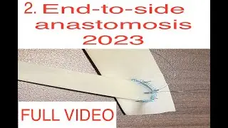 End-to-side vascular anastomosis, fixed donor limb, 2023, extended