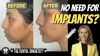 Facial Fillers! Non-Surgical Cosmetic Enhancers! 