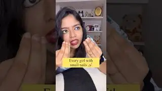 Kutty nails kodumaigal😂 | #ytshorts #missmiracle