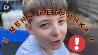 Как я переболел Ветрянкой