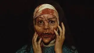 In Modern World Plastic Surgery Is Considered To Be The Reason Behind Your Beauty