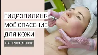 Hydropeeling: what do you need to know? Vacuum facial cleansing. Peeling in summer. What does hyd...