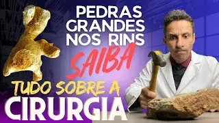 Tudo o que você precisa saber sobre a Cirurgia Percutânea para Cálculos Renais - Dr Heleno Paes