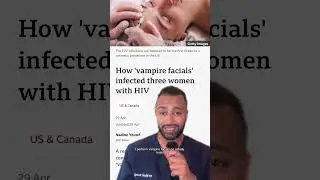 People are getting HIV from vampire facials!? #vampirefacials #HIV #skinshort #hivfromvampirefacials