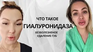 ЧТО ТАКОЕ ГИАЛУРОНОВАЯ КИСЛОТА? ЧТО ТАКОЕ ГИАЛУРОНИДАЗА? БЕЗБОЛЕЗНЕНОЕ УДАЛЕНИЕ ГУБ