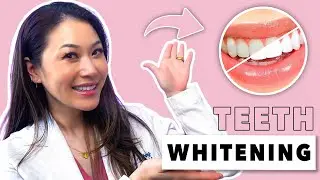 Professional Teeth Whitening at the Dentist