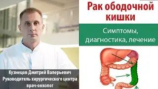 Рак ободочной кишки. Симптомы, диагностика, лечение