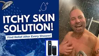 Is your Skin Irritated after Showering? Watch this | Angel Water, Inc
