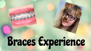 My Braces experience