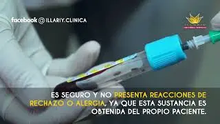 Clip Plasma Gel - Procedimiento