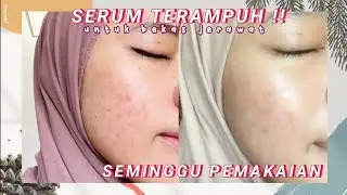 SERUM TERAMPUH NGILANGIN BEKAS JERAWAT 💯 GLOWTENING SERUM SCARLETT | KeeRun