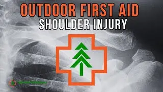 What To Do After A Shoulder Separation Outdoors?