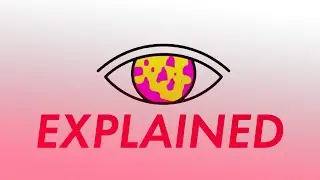 How 2020 Vision 