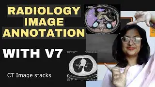 Annotating Radiology Images with V7: An Annotator's Guide