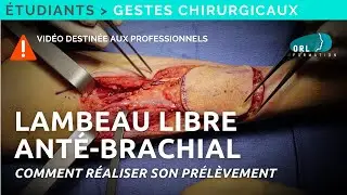 Prélèvement d'un lambeau libre anté-brachial | Formation chirurgie ORL