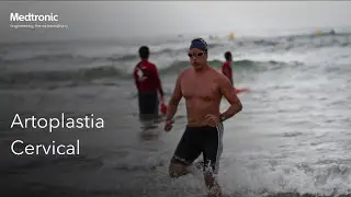 Historias de pacientes "Artoplastia Cervical", ¡50 Años Medtronic MX y CA!
