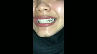 Zoom closeup teeth, long tongue uvula girl indo