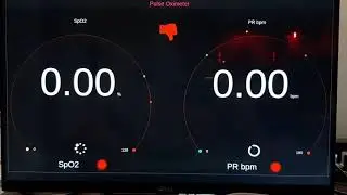 Raspberry Pi 400 Pulse Oximeter displaying full screen on TV Monitor